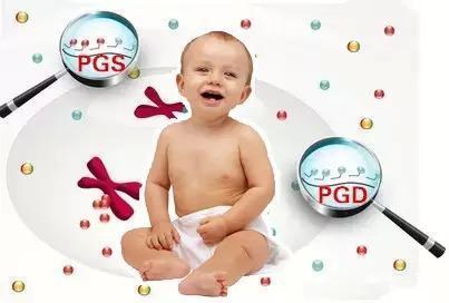 男性不妊